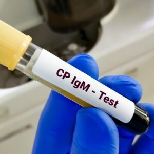 Chlamydia lgG/IgM