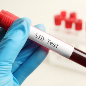 Comprehensive STD Panel