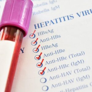 Hepatitis A, B & C Test