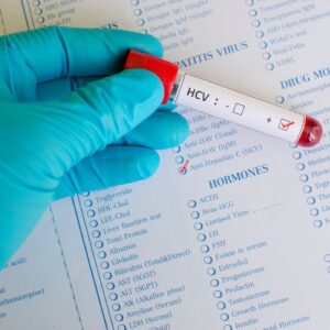 (HCV) Hepatitis C Virus RNA Test