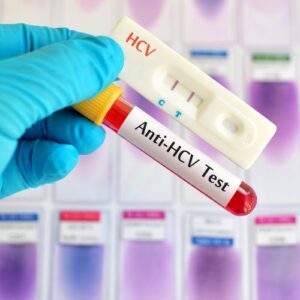 (HCV) Hepatitis C Virus Antibody Test